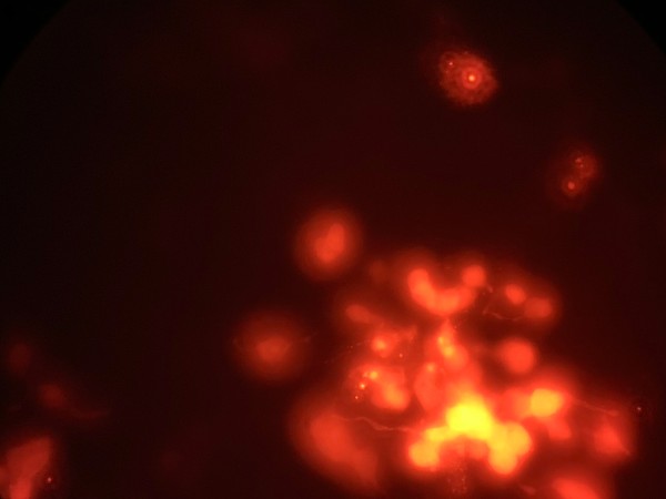 Lovesick: The Transfection